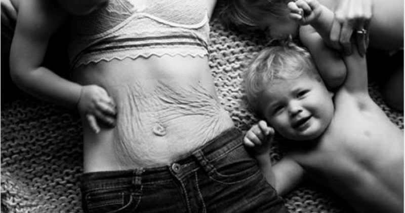 ქალები აქვეყნებენ სურათებს, როგორ გამოიყურება მათი სხეული მშობიარობის შემდეგ