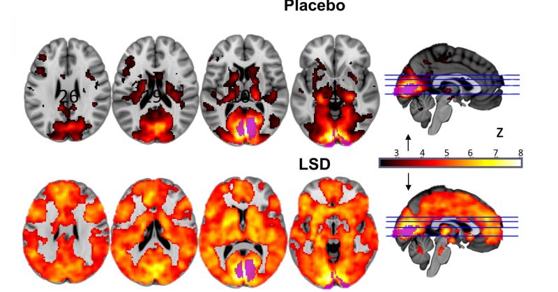 როგორ ცვლის LSD ტვინის აქტივობას?