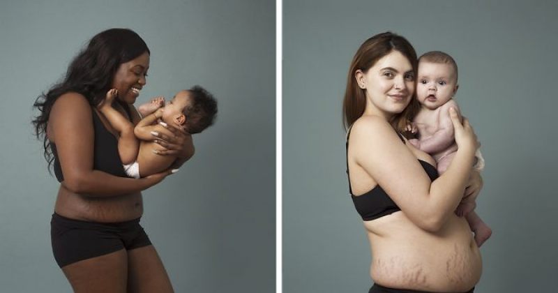 როგორ გამოიყურებიან დედები მშობიარობის შემდეგ - ფოტოპროექტი