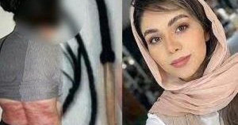 ირანელი ქალი ჰიჯაბის გაკეთებაზე უარის გამო 74-ჯერ გაამათრახეს 