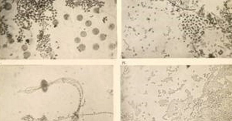 ჩარლზ დარვინის ბიბლიოთეკიდან ბაქტერიის პირველი ფოტო გასაჯაროვდა 
