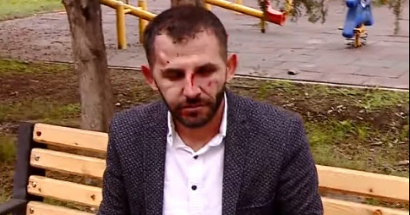 "ეს იყო ორგანიზებული თავდასხმა" – მარნეულში, საარჩევნო უბანზე ოპოზიციის წევრს სცემეს