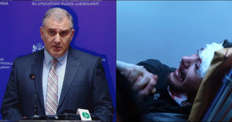 სარჯველაძის მტკიცებით, თირქიამ ოპერაციის დაფინანსებაზე უარი კლინიკის შეცდომის გამო მიიღო