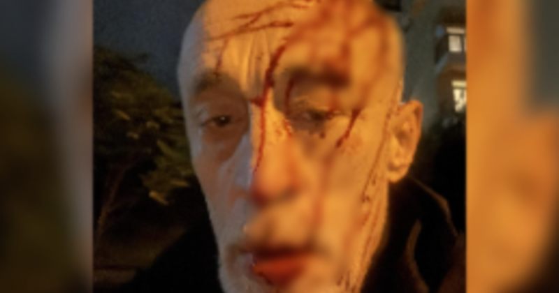 "დამაგდეს და თავში მირტყეს ფეხები" - ნადიმ ხმალაძეს თავს დაესხნენ 